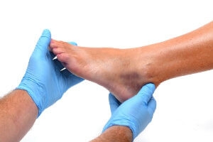 Foot and Ankle Pain